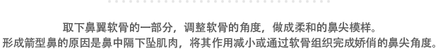 取下鼻翼软骨的一部分，调整软骨的角度，做成柔和的鼻尖模样。形成箭型鼻的原因是鼻中隔下坠肌肉，将其作用减小或通过软骨组织完成娇俏的鼻尖角度。
