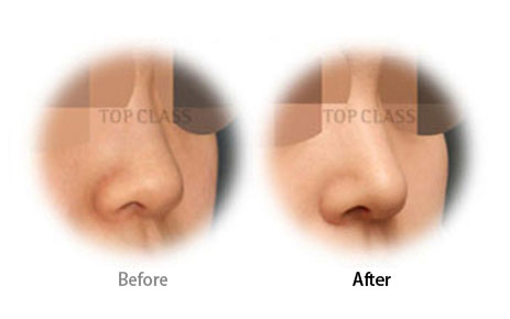 Case02 Before and After