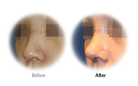 Case06 Before and After