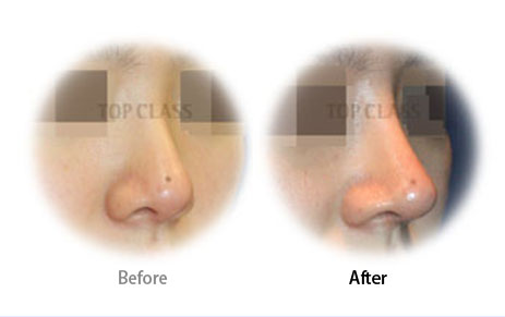 Case07 Before and After