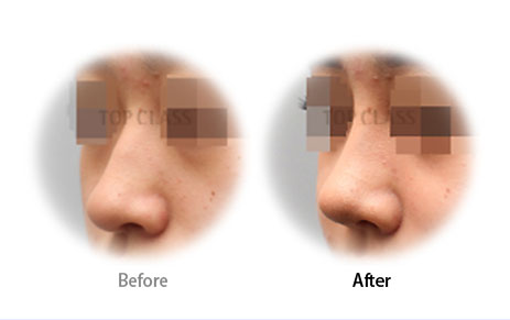 Case08 Before and After