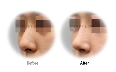 Case12 Before and After