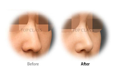 Case03 Before and After