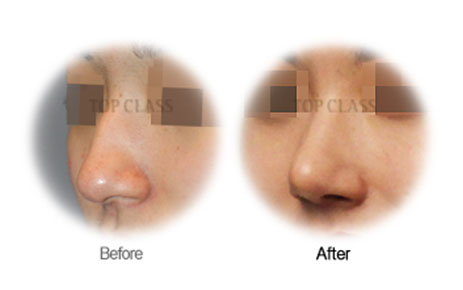 Case01 Before and After