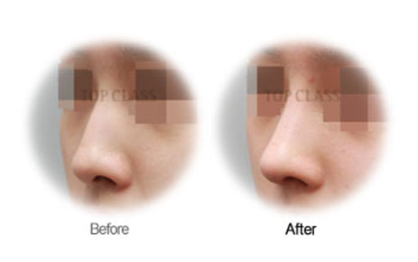 Case01 Before and After