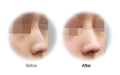 Case03 Before and After