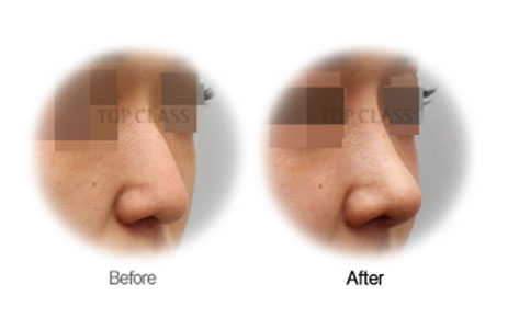 Case02 Before and After