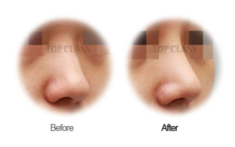 Case03 Before and After