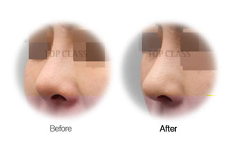 Case03 Before and After