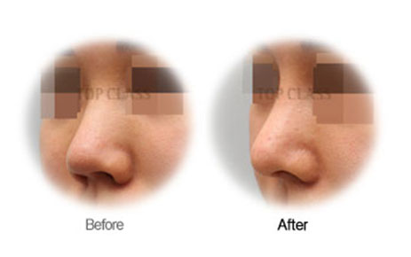 Case04 Before and After