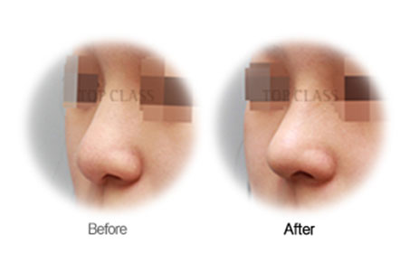 Case01 Before and After