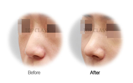 Case05 Before and After