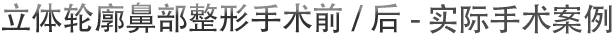 立体轮廓鼻部整形手术前/后 - 实际手术案例