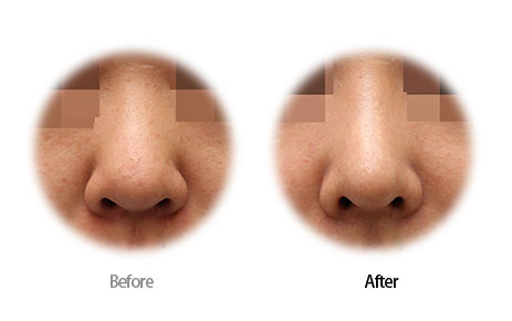 Case07 Before and After