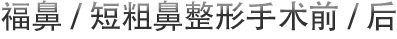福鼻/短粗鼻整形手术前/后
