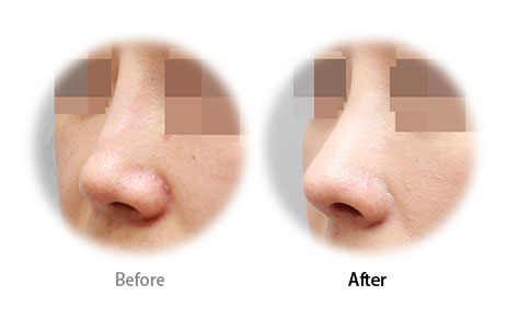 Case12 Before and After