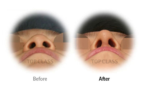 Case01 Before and After