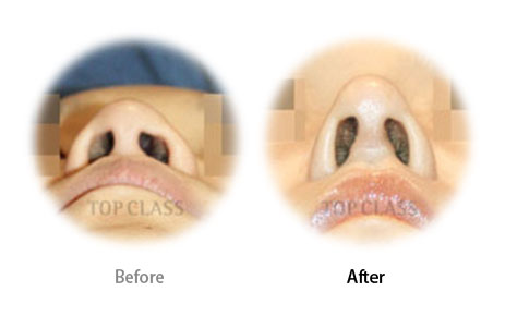 Case02 Before and After