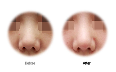 Case06 Before and After