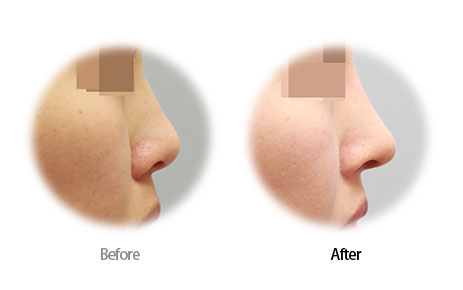 Case08 Before and After