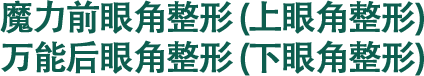 魔力前眼角整形 (上眼角整形) 万能后眼角整形 (下眼角整形)