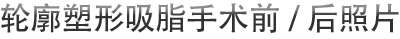 轮廓塑形吸脂手术前/后照片