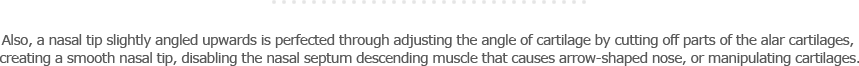 Also, a nose tip slightly angled upwards is perfected through adjusting the angle of cartilage by cutting off parts of the wing cartilages, creating a smooth nose tip, disabling the nasal septum descending muscle that causes arrow-shaped nose, or manipulating cartilages.