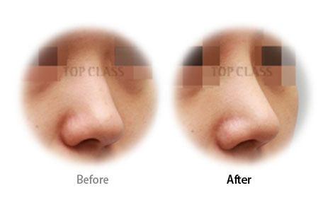 Case03 Before and After