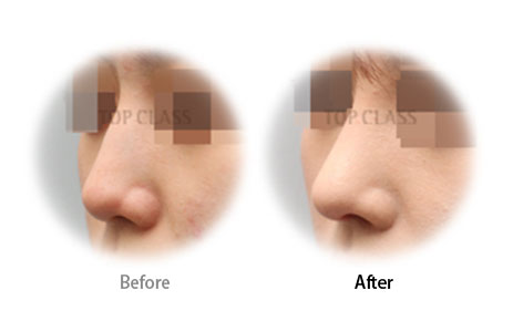 Case01 Before and After