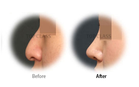 Case04 Before and After