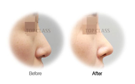 Case05 Before and After