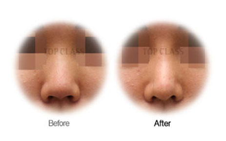 Case02 Before and After