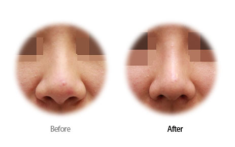 Case09 Before and After