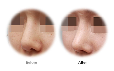 Case09 Before and After