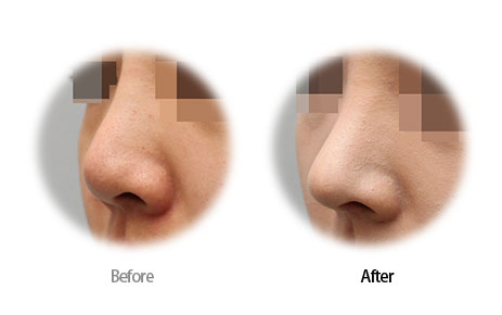 Case02 Before and After
