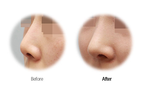 Case12 Before and After