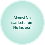 Almost No Scar Left from No Incision