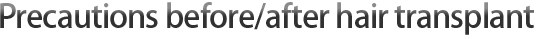 毛发移植手术前/后注意事项